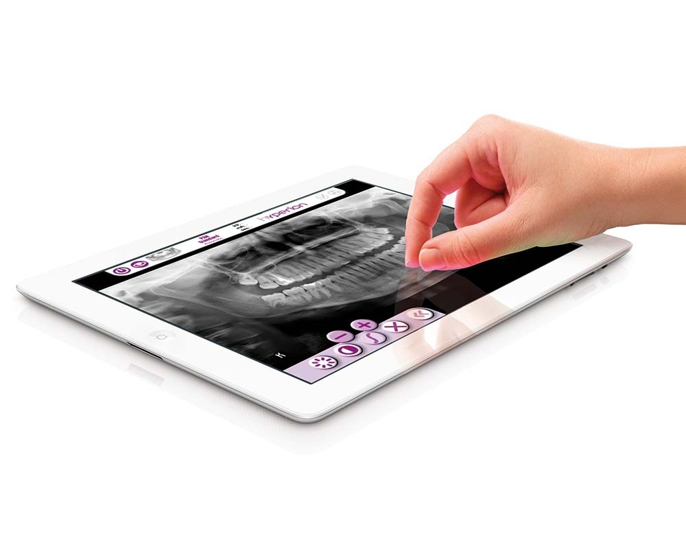 Hyperion X9, Myray hyperion-x9,-myray