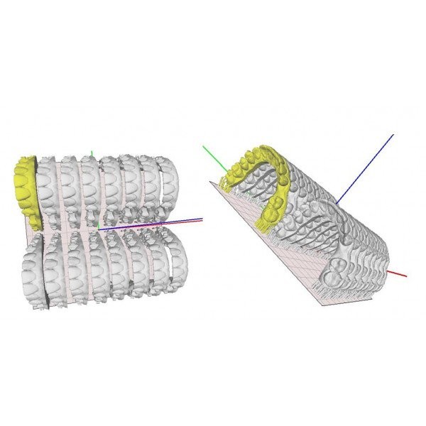 Basic (Dental) - профессиональный 3D-принтер для стоматологии Basic (Dental) - профессиональный 3D-принтер для стоматологии