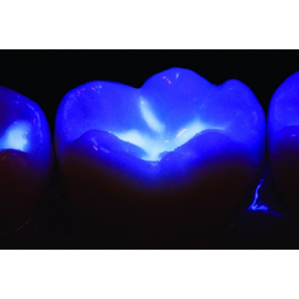 VALO-Blacklight - насадка 'блэклайт' для определения флуоресценции композитов VALO-Blacklight - насадка 'блэклайт' для определения флуоресценции композитов