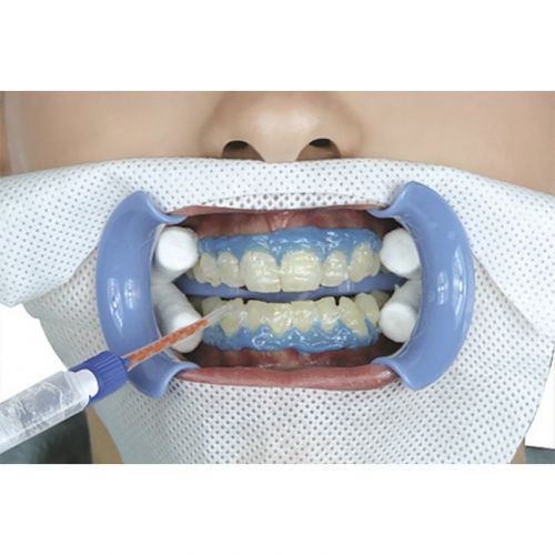 Гель отбеливающий Dual-Barrel Syringe of Beyond II Whitening Gel (4 г)