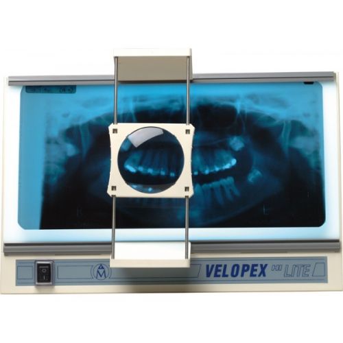 Velopex Hi Lite Viewer - стоматологический негатоскоп для интраоральных и панорамных рентгенограмм, с лупой