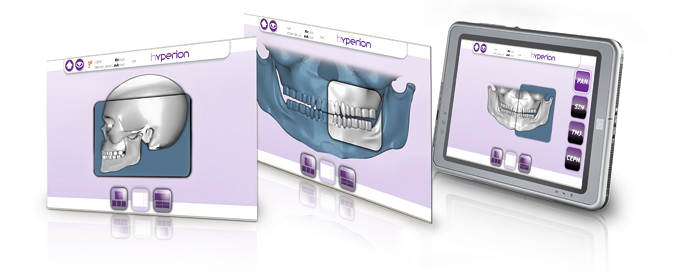 programmy-panoramnogo-rentgen-appatara-hyperion-mrt